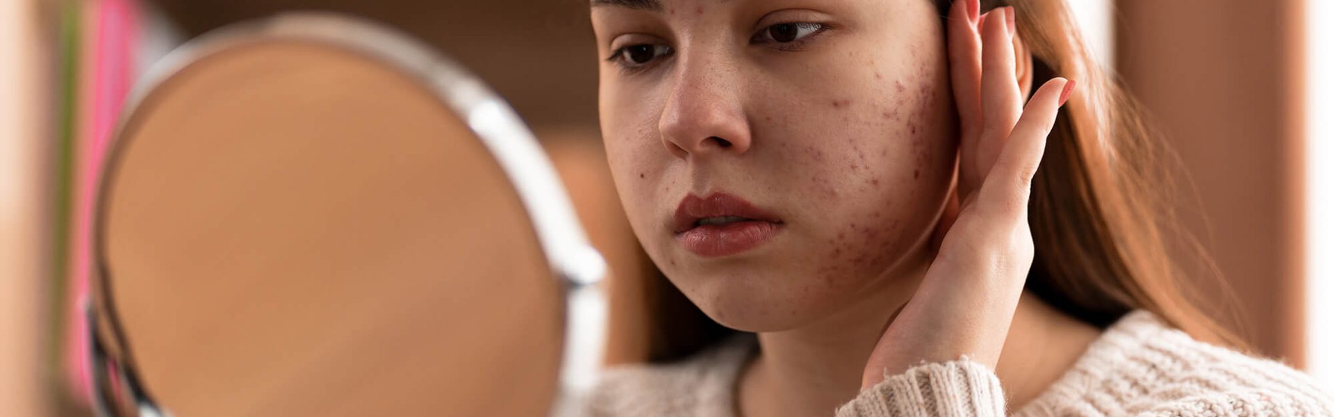 clarity-person-dealing-with-rosacea