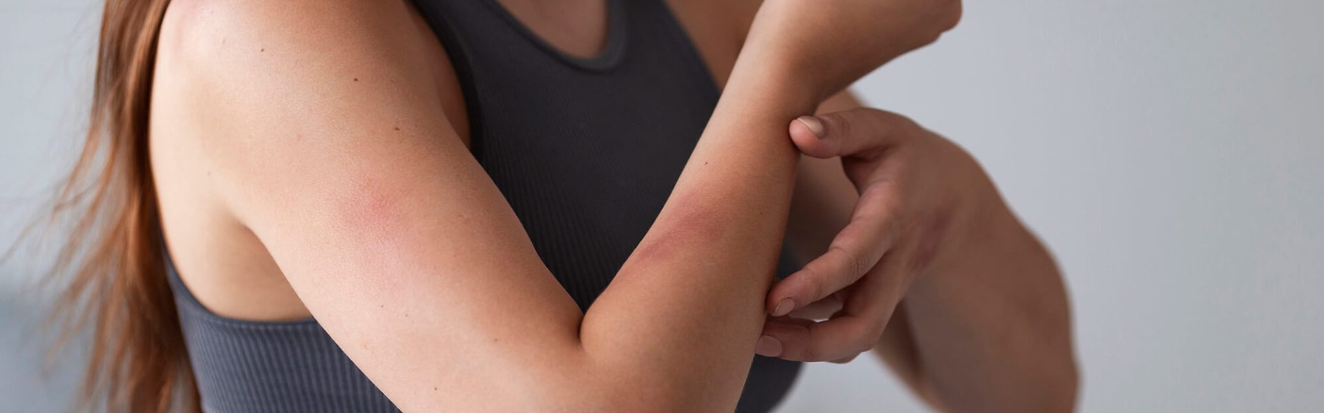 clarity-woman-suffering-from-rash